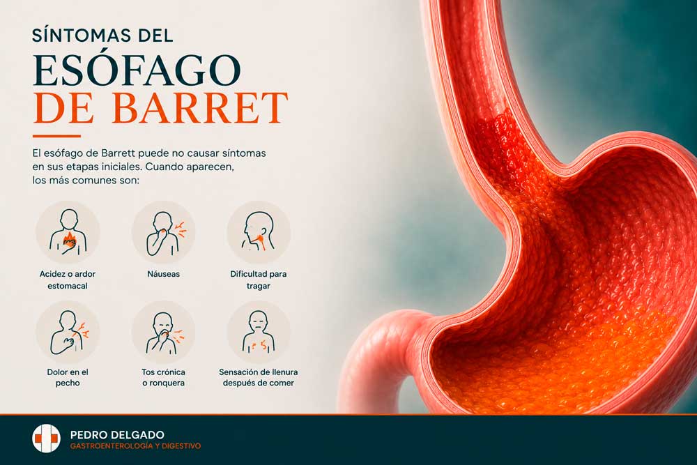 Síntomas del esófago de Barret