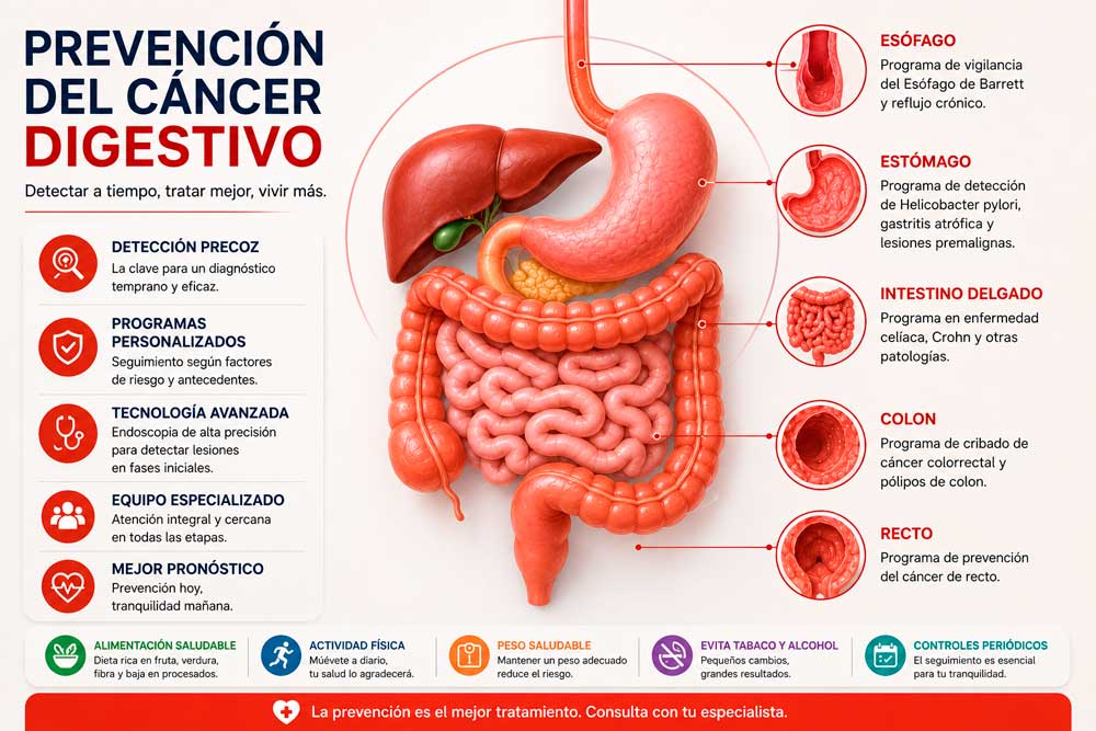 Aparato digestivo completo con las áreas donde se aplican los programas de prevención del cáncer digestivo