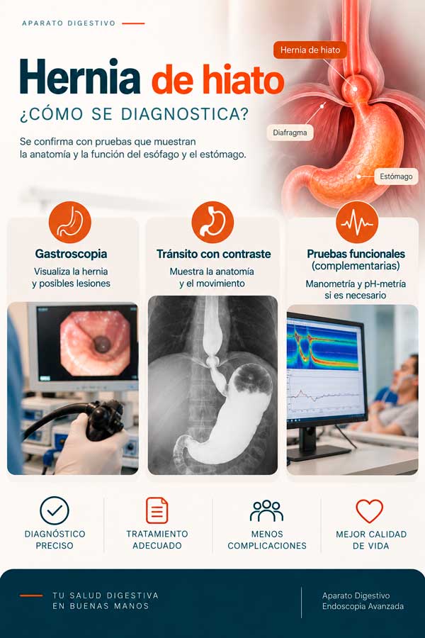 Diagnóstico de la hernia de hiato Pruebas para diagnosticar la hernia de hiato: gastroscopia, tránsito con contraste y estudios funcionales