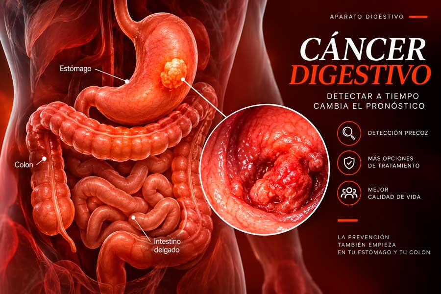 Ilustración anatómica del aparato digestivo con lesiones representadas en el estómago y el colon
